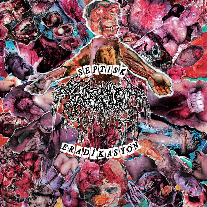 SEPTAGE Septisk Eradikasyon MCD